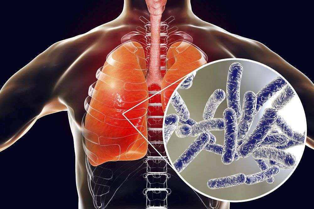 Rentokil Initial recuerda la necesidad de mantener controles y tratamientos preventivos contra la Legionella