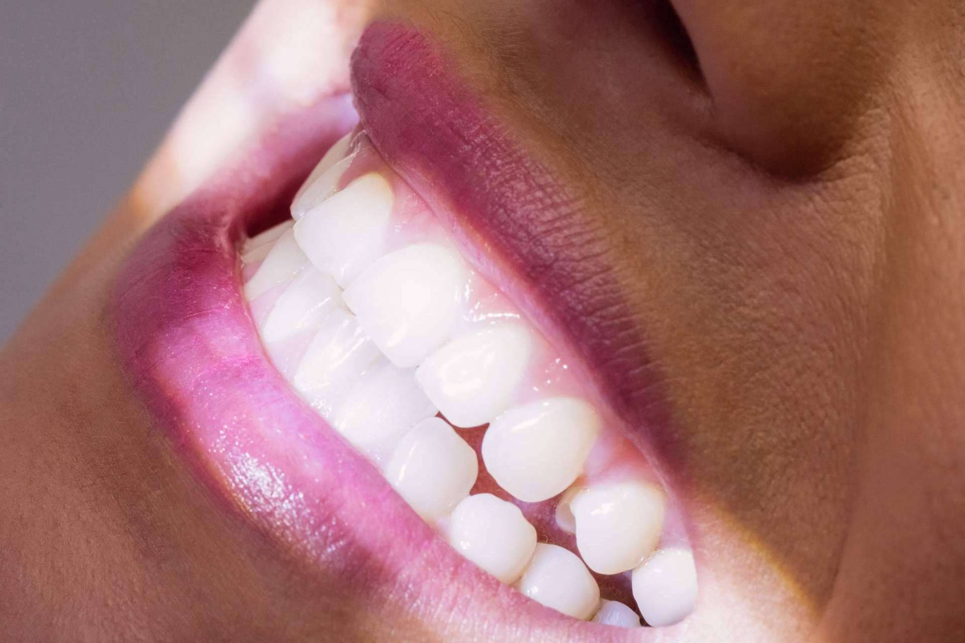 Tratamiento exclusivo de blanqueamiento dental con Zoom LED ahora a mitad de precio en Clínica Calvo de Mora